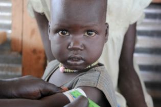 malnutrition treatment_315x210.jpg